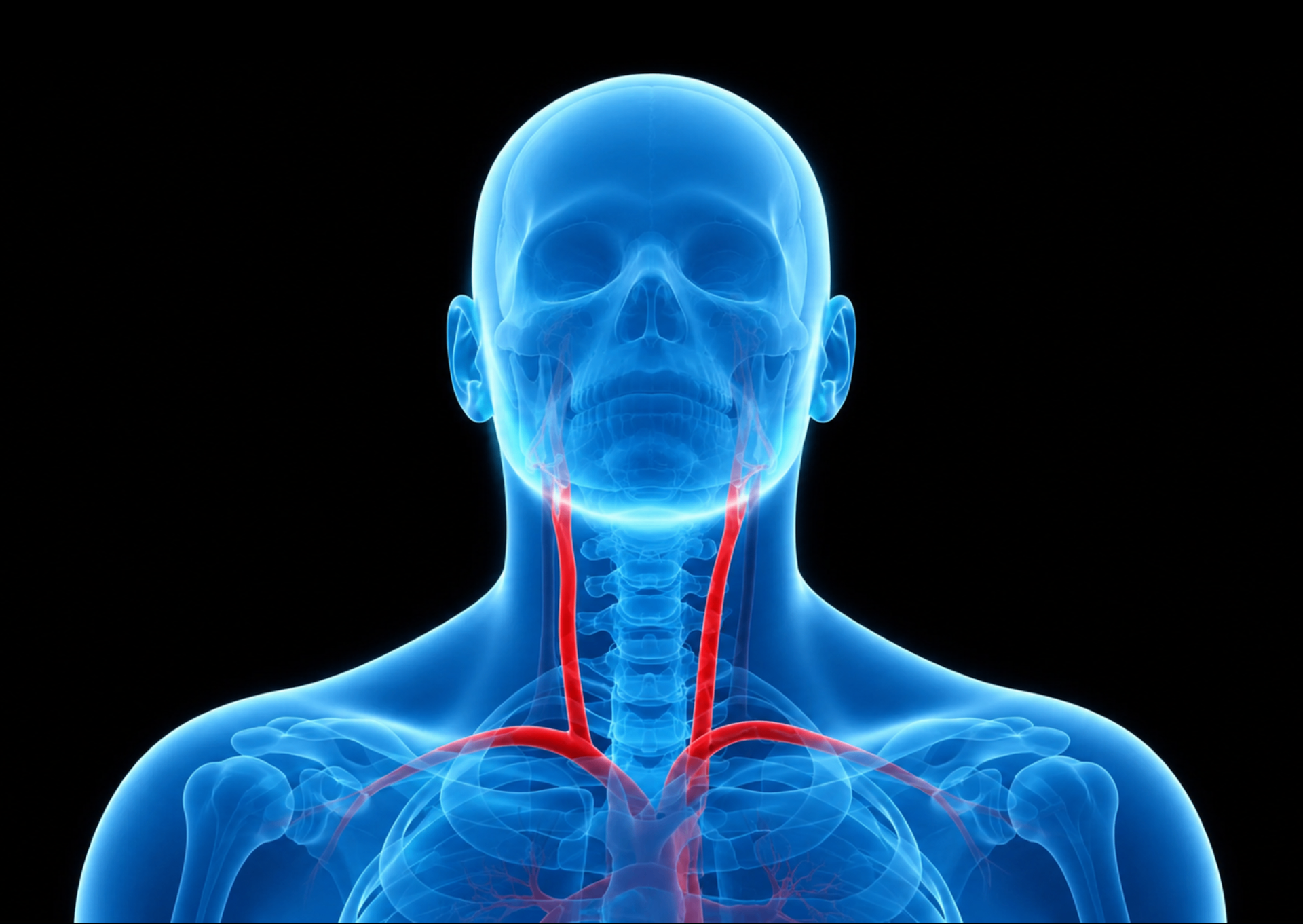 Doenças das artérias carótidas e vertebrais